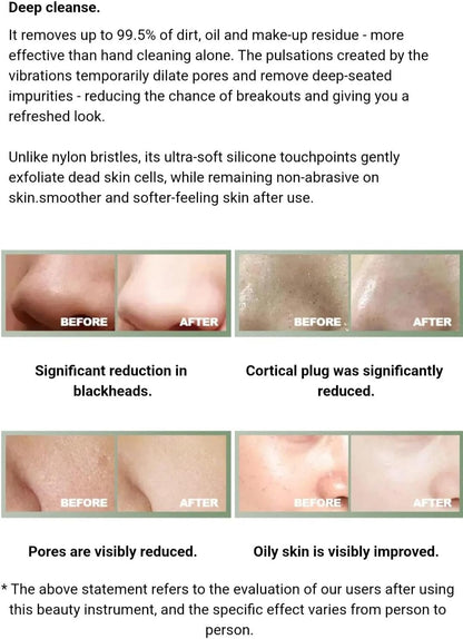 Sonic brush silicone bristle surface close-up — gentle exfoliating nubs detail