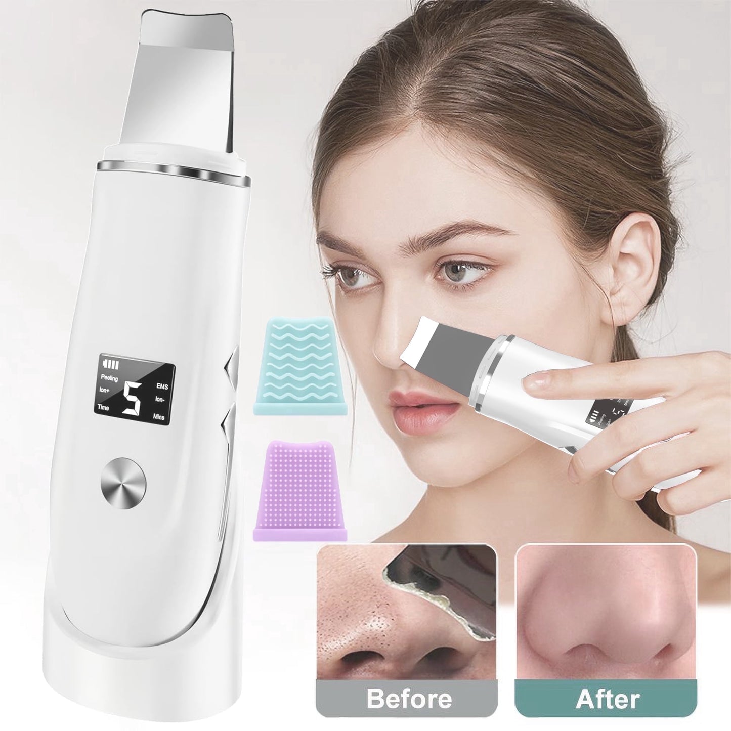 Miraveila Ultrasonic Skin Spatula — 4-mode pore cleaner and blackhead remover